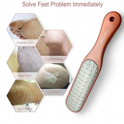 Foot File Callus Remover for Feet | 2-in-1 Foot Scrubber for Dead Skin Remover | LUXE Collection - Rose Gold
