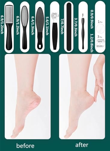 Pedicure Tools for Feet - 8 in 1 Pedicure Kit | Foot Scrubber for Dead Skin, Callus Remover, Foot Scraper, Foot File, Pitchfork, Filer for Nail Repair - 1 Set (Black)