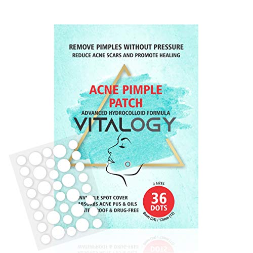 Acne Pimple Patch | Advanced Hydrocolloid Acne Patches Formula - Pimple Patches for Face | OVERNIGHT Treatment - 36 Dot Patches (2 Sizes)