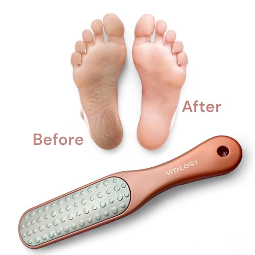 Foot File Callus Remover for Feet | 2-in-1 Foot Scrubber for Dead Skin Remover | LUXE Collection - Rose Gold