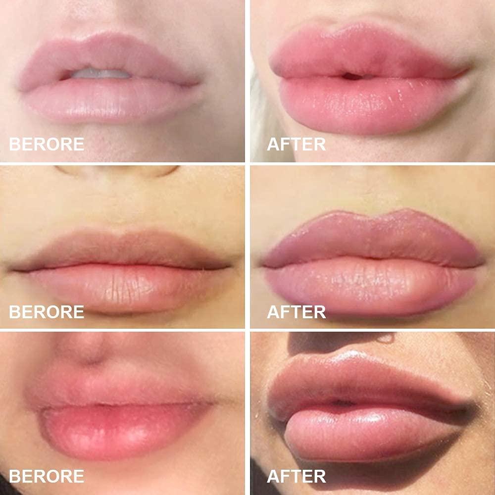 Lip Plumper for Women - Fish Shape Lip Enhancer Plumper Device Natural Pout Mouth Tool - 1 Pc