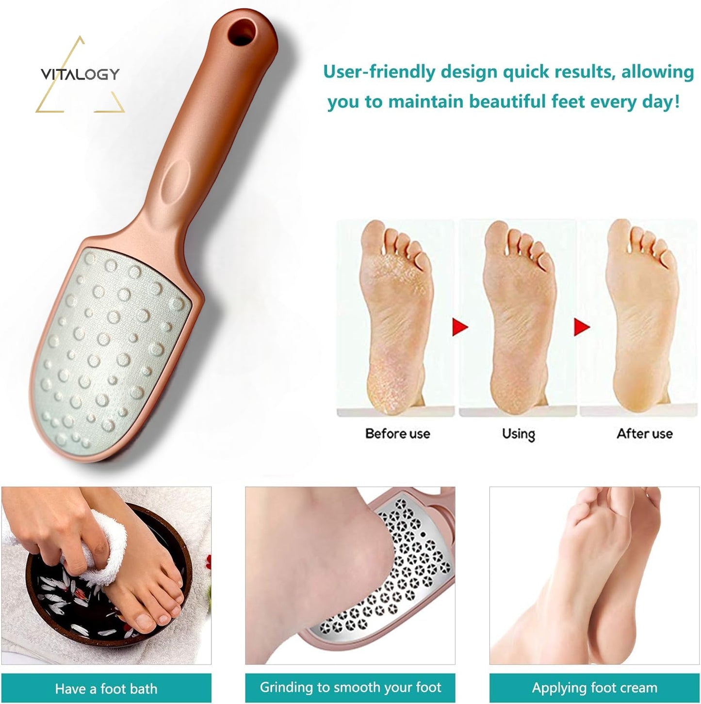 Callus Remover for Feet | Double-sided Foot Scrubber with Removable Plate and Container for Dead Skin | Rose Gold With Dander Collection Cavity