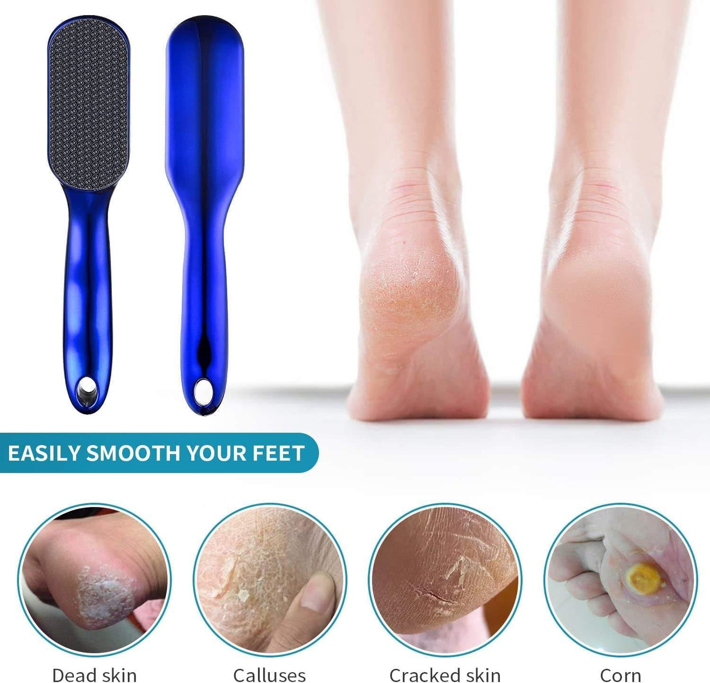 Callus Remover for Feet | NANO GLASS CRYSTAL Removes Hard Skin, Leaves Feet Smooth - CHAMPAGNE GOLD with Handle