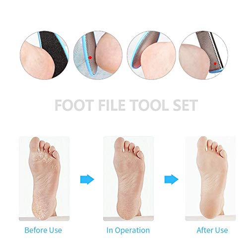 Pedicure Tools for Feet - 8 in 1 Pedicure Kit | Foot Scrubber for Dead Skin, Callus Remover, Foot Scraper, Foot File, Pitchfork, Filer for Nail Repair - 1 Set