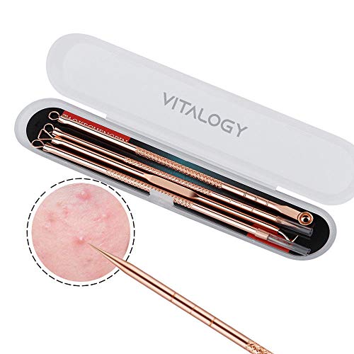 Blackhead Remover Tool Kit - 4 in 1 Acne and Pimple Removal Tool - Nose & Face Blackheads Remover - ROSE GOLD
