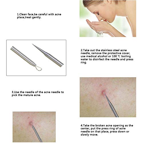 Blackhead Remover Tool Kit - 4 in 1 Acne and Pimple Removal Tool - Nose & Face Blackheads Remover - ROSE GOLD