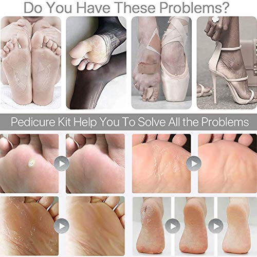 Pedicure Tools for Feet - 8 in 1 Pedicure Kit | Foot Scrubber for Dead Skin, Callus Remover, Foot Scraper, Foot File, Pitchfork, Filer for Nail Repair - 1 Set