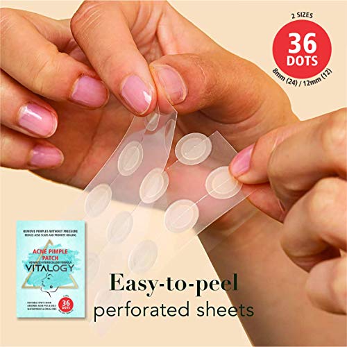 Acne Pimple Patch | Advanced Hydrocolloid Acne Patches Formula - Pimple Patches for Face | OVERNIGHT Treatment - 36 Dot Patches (2 Sizes)