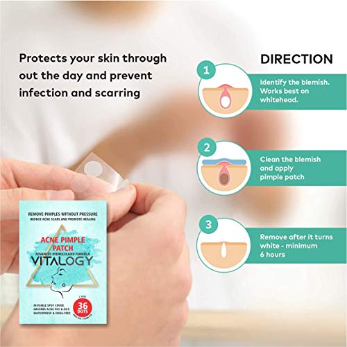 Acne Pimple Patch | Advanced Hydrocolloid Acne Patches Formula - Pimple Patches for Face | OVERNIGHT Treatment - 36 Dot Patches (2 Sizes)