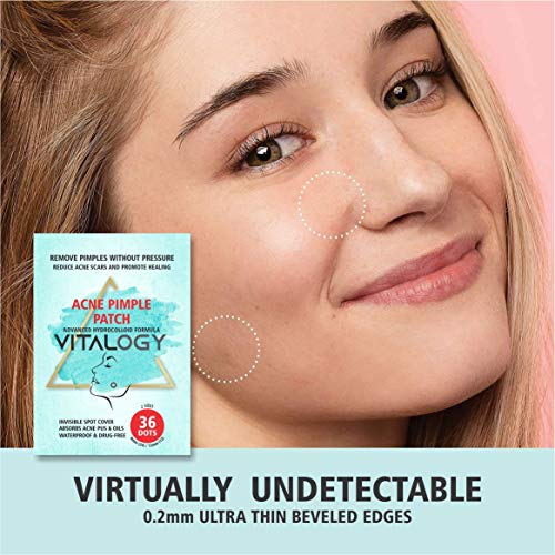 Acne Pimple Patch | Advanced Hydrocolloid Acne Patches Formula - Pimple Patches for Face | OVERNIGHT Treatment - 36 Dot Patches (2 Sizes)